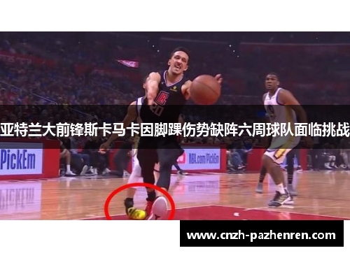 亚特兰大前锋斯卡马卡因脚踝伤势缺阵六周球队面临挑战